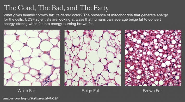 UCSF Scientists are looking at ways that humans can leverage beige fat to convert energy-storing white fat into energy-burning brown fat.
