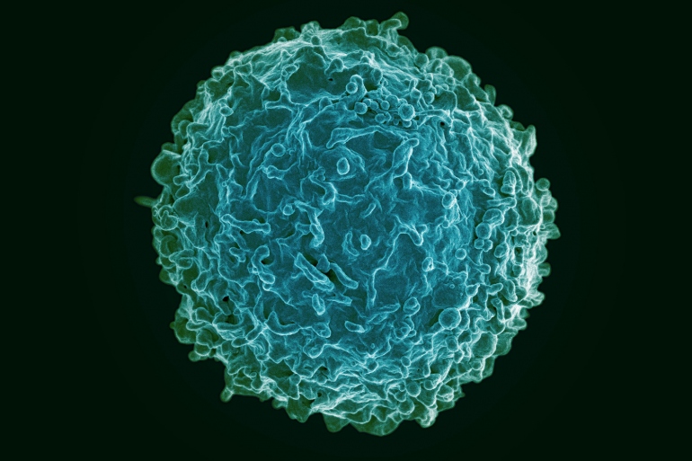 scanning electron micrograph of B cell