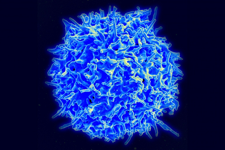scanning electron micrograph of T cell