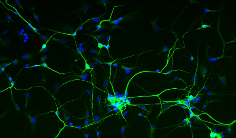 human neurons that have been derived from stem cells are shown highlighted in gree