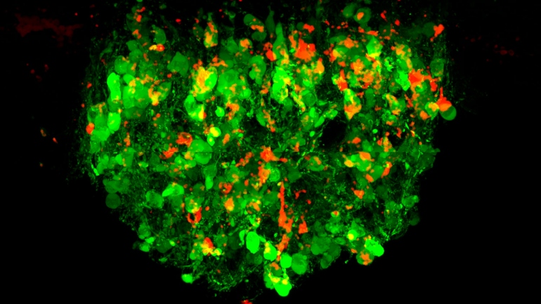 Science image of green and red neuron receptors.