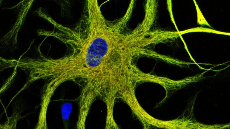 a microscopic image of human astrocytes