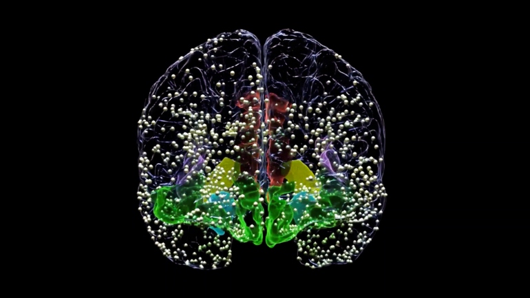 Brain image illustrating electrode recording sites.