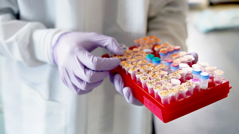 researcher's hand holding a tray of genetic samples