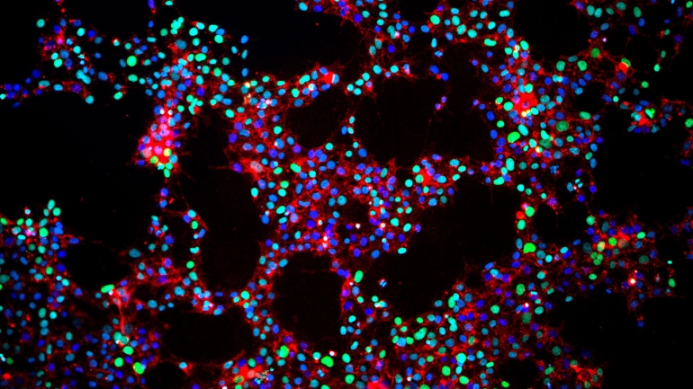 microscopic view of induced pluripotent stem cells