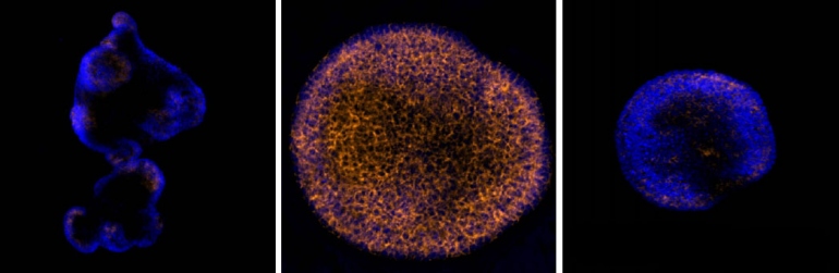 cellular proteins seen through a microscope