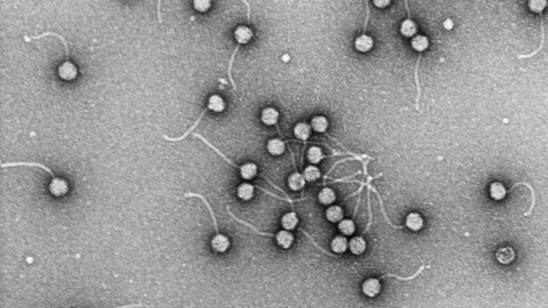 Black and white science image of phages