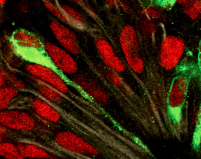 Infection of developing human brain with the Zika virus (green) highlights susceptibility of radial glial cells during fetal development.