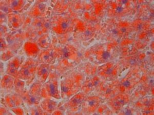 A group of normal cells.