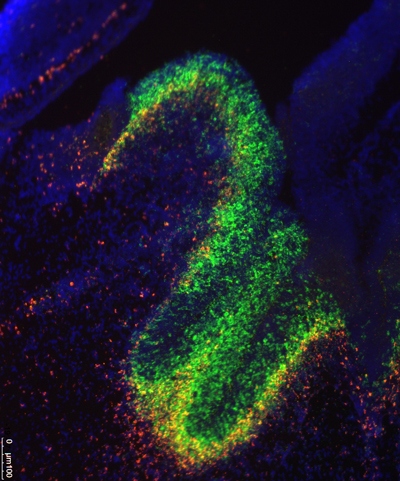 Fluorescent dyes track the presence of the RNA molecules and the genes they  affect in the developing mouse brain. 