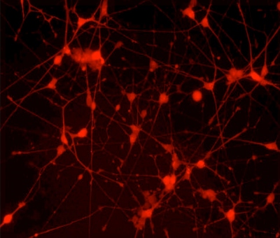 UCSF researchers made human brain cells from stem cells in the lab and  transplanted them into mice, where they became functioning “interneurons” (seen in  red) and integrated into local nerve circuits
