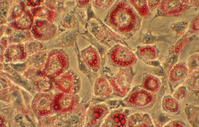 Fat cells shown under a microscope