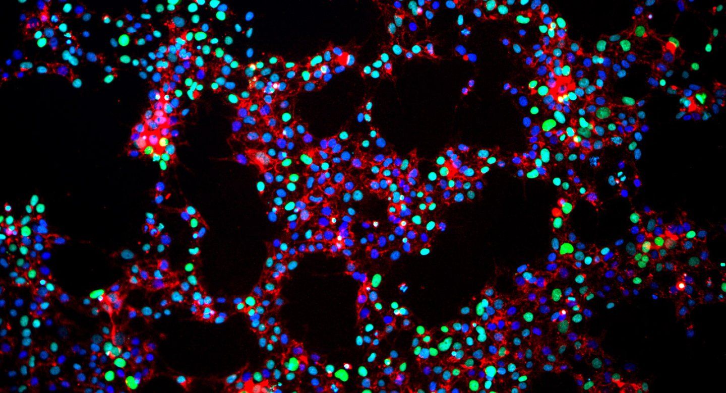 Microscopic image of ips cells. 