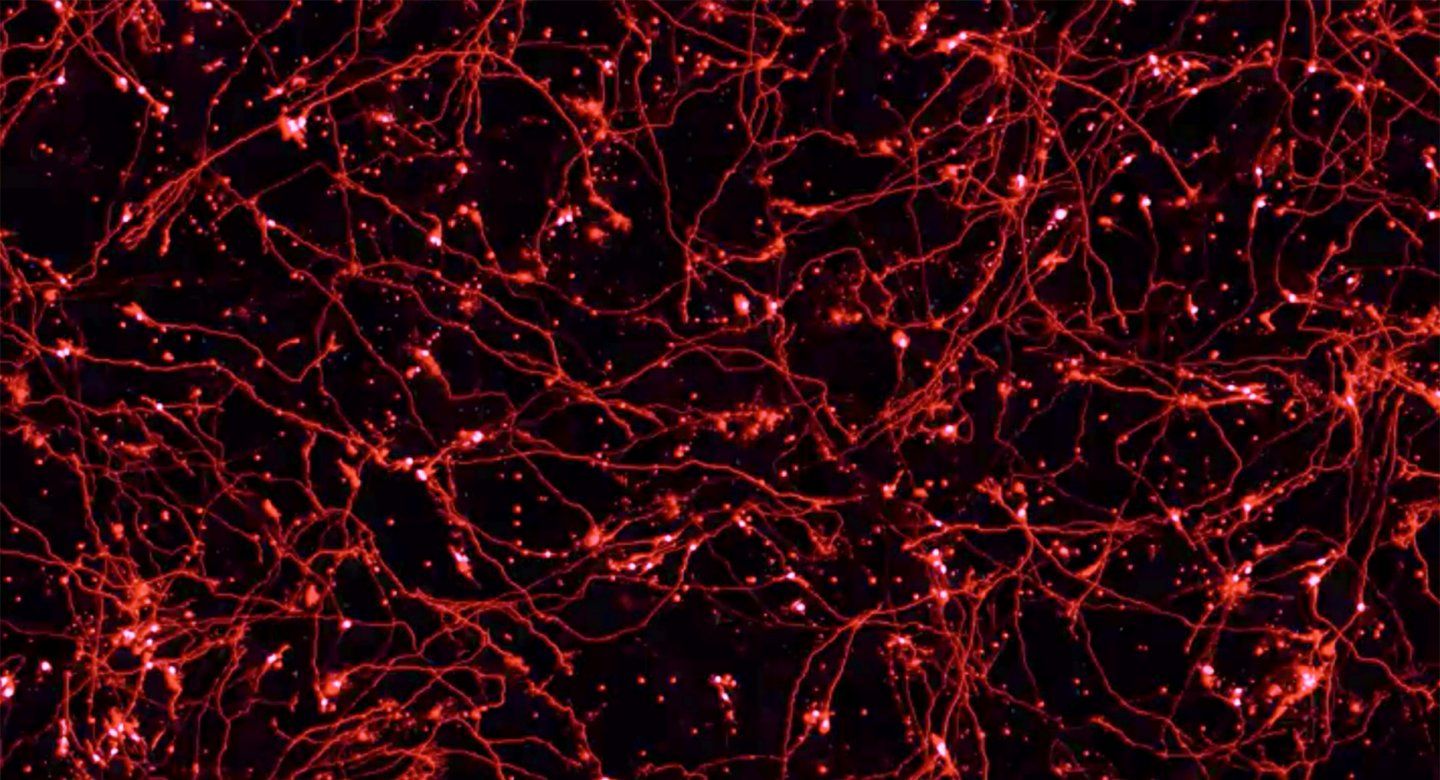 microscopic image of neurons