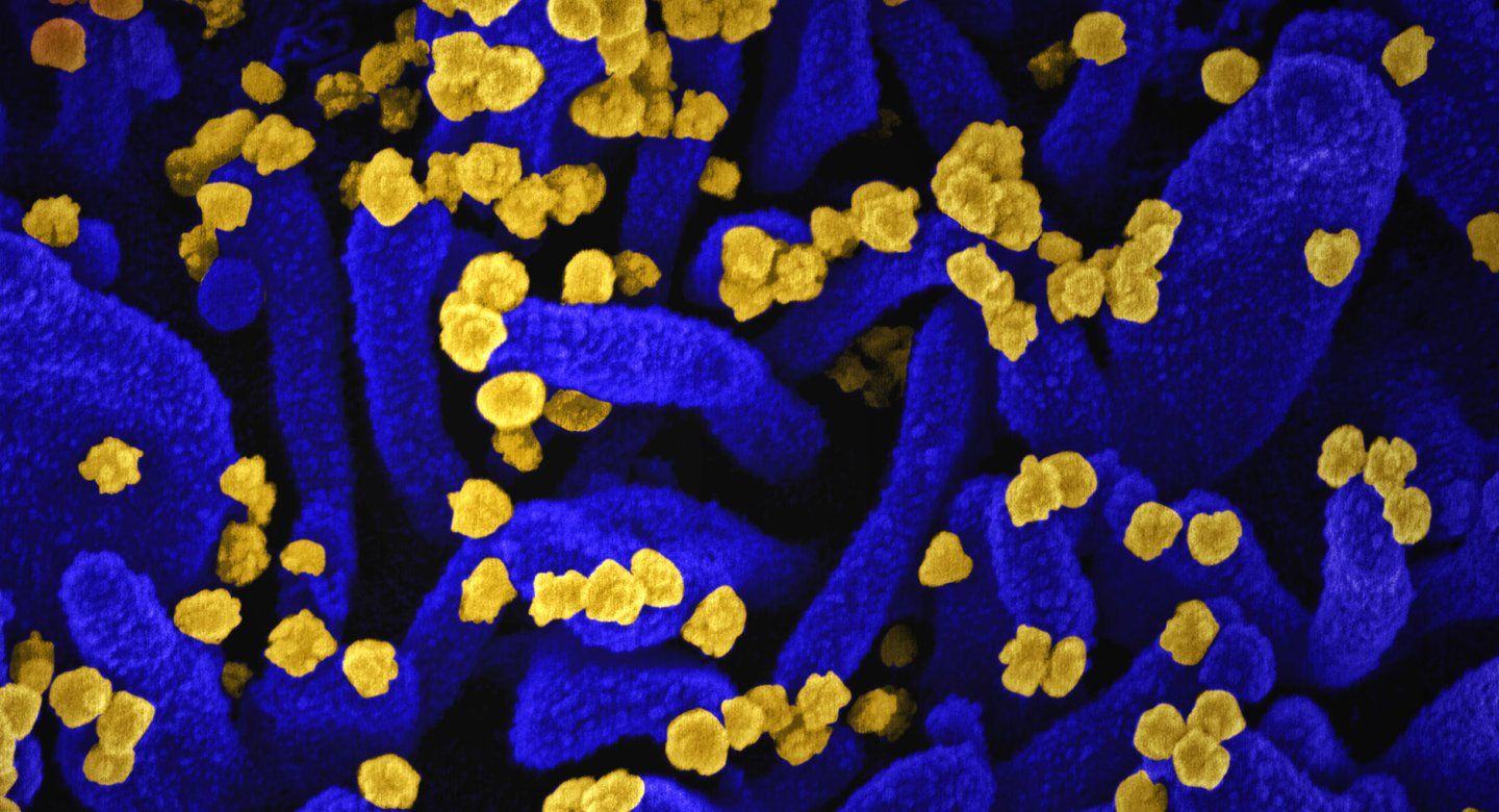 microscopic image shows coronavirus 