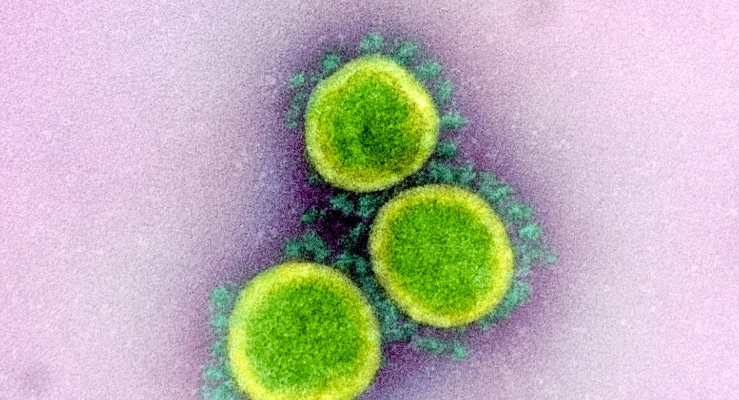 Transmission electron micrograph of SARS-CoV-2 virus particles