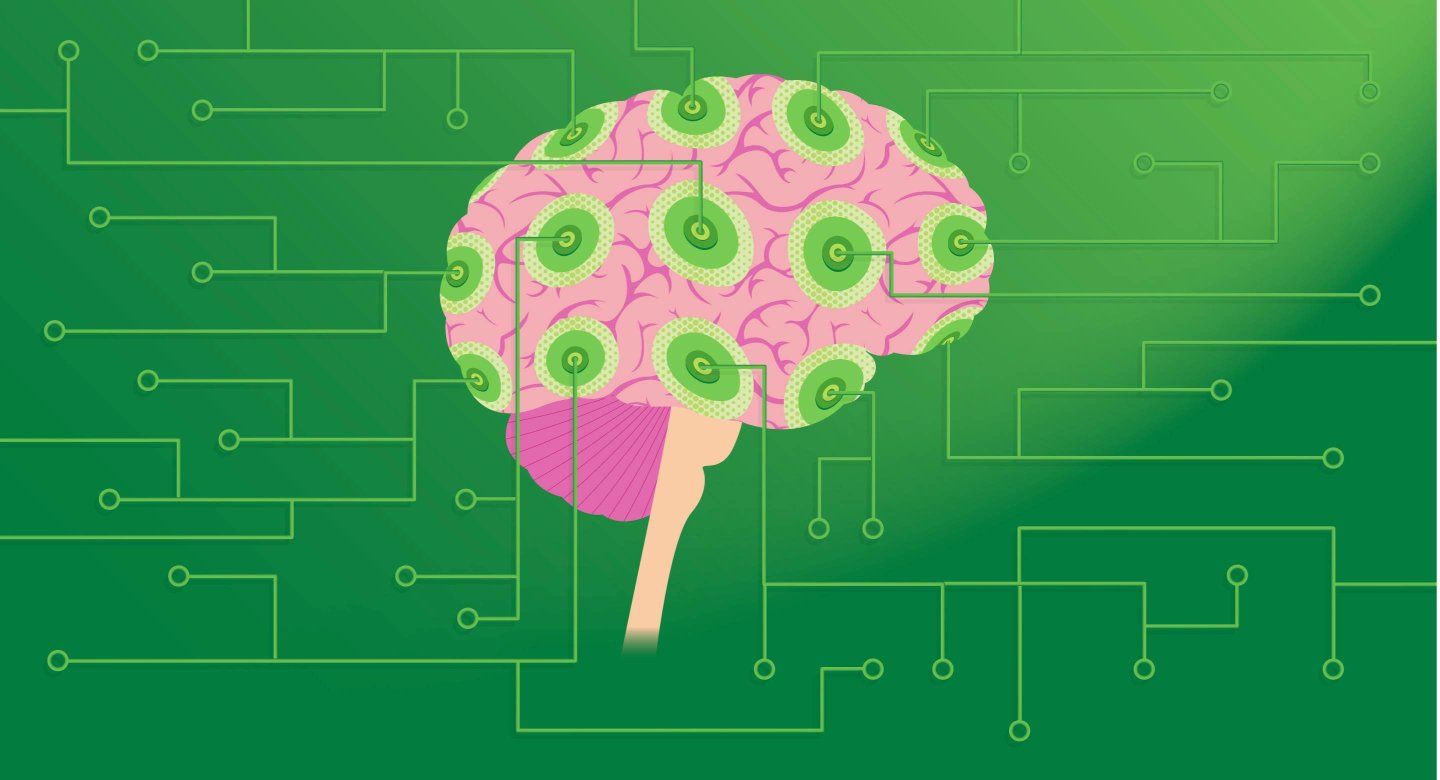 A stylized illustration of a human brain with a pink and green circuit-like design.
