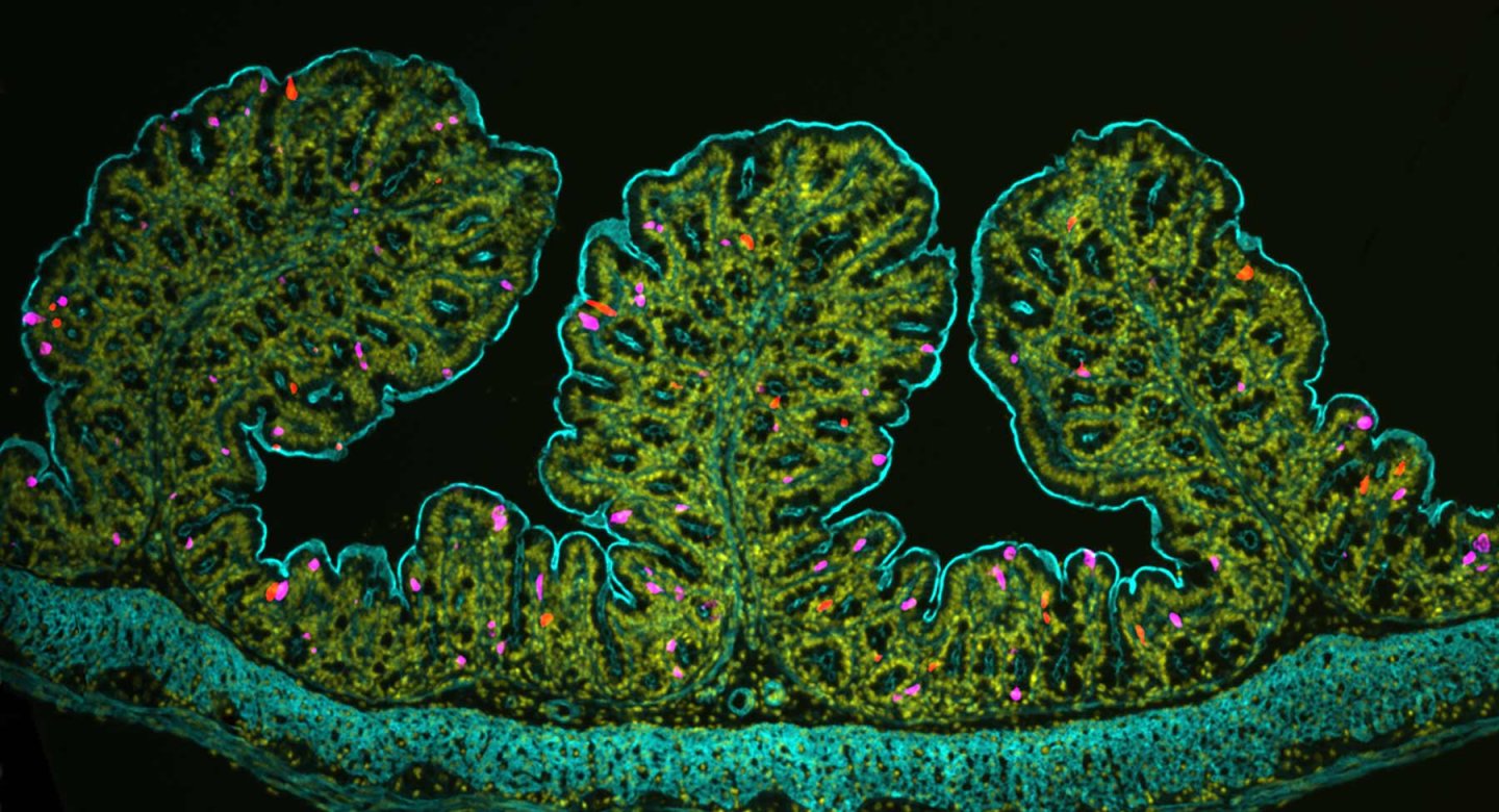 Microscopic image of a zoomed in segment of proximal colonic epithelium.