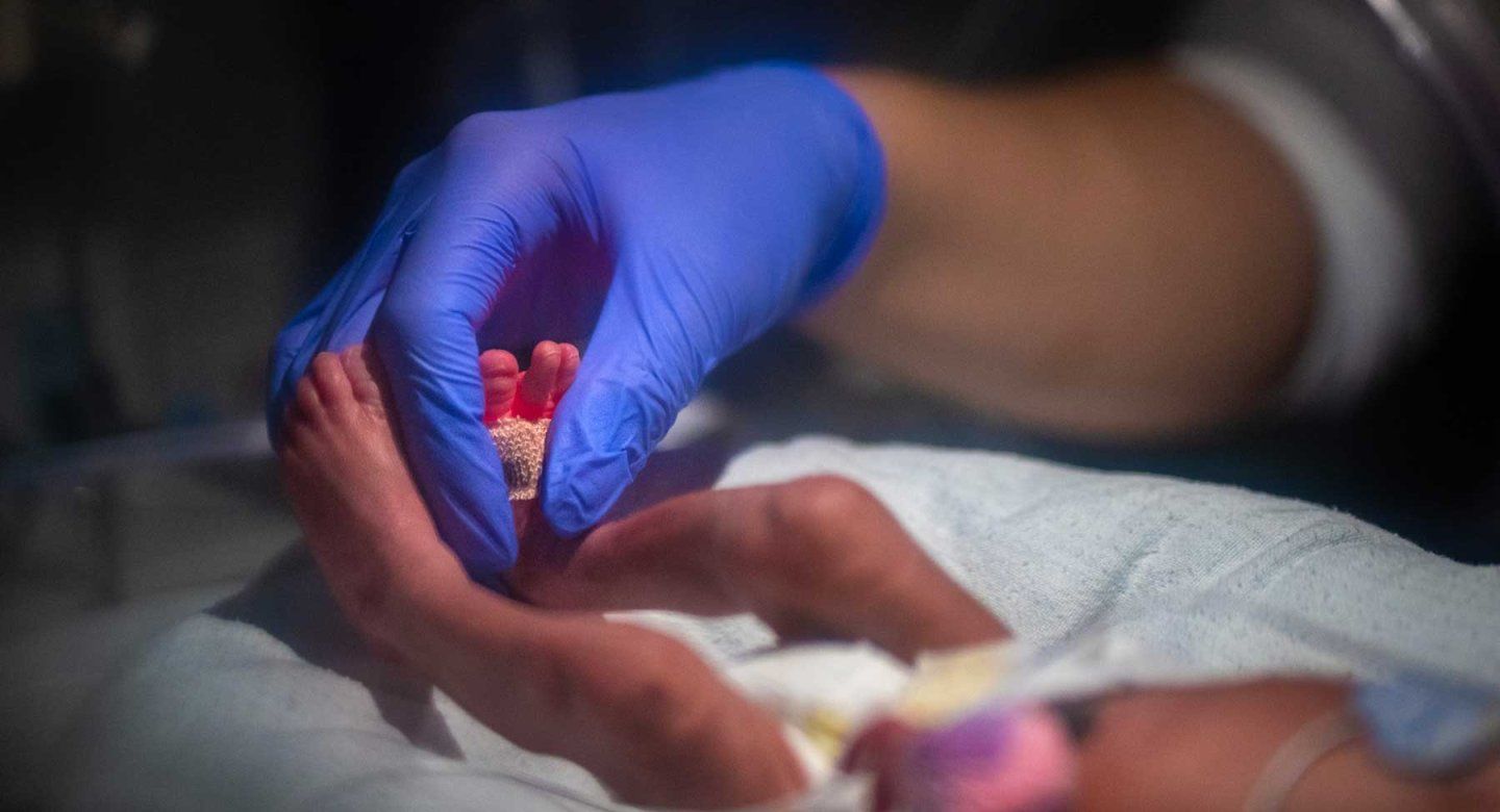 A NICU nurse wears a blue latex glove as she soothes a premature baby at a neonatal intensive care unit.