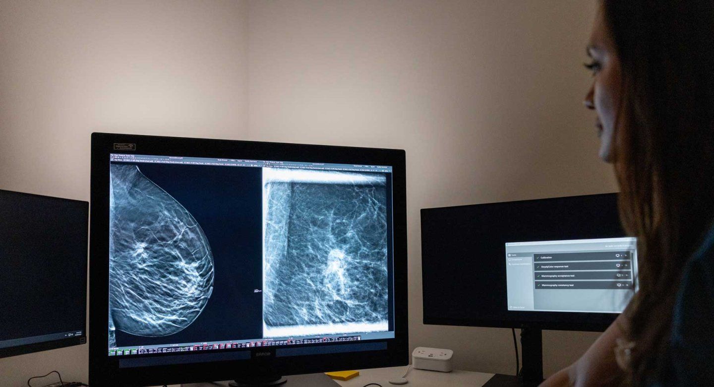 A medical practitioner looks at mammogram scans on a computer screen.