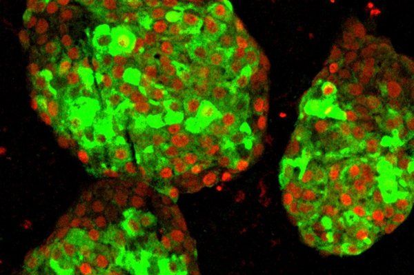 microscopic image of pancreatic beta cells