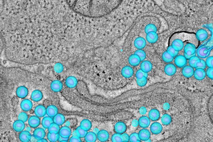 Microscopic image of HIV