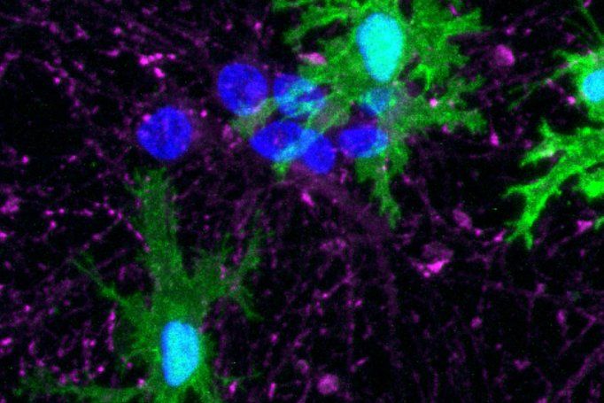 Microscopic image of microglia (green) derived from human stem cells by members of the Kampmann lab. 