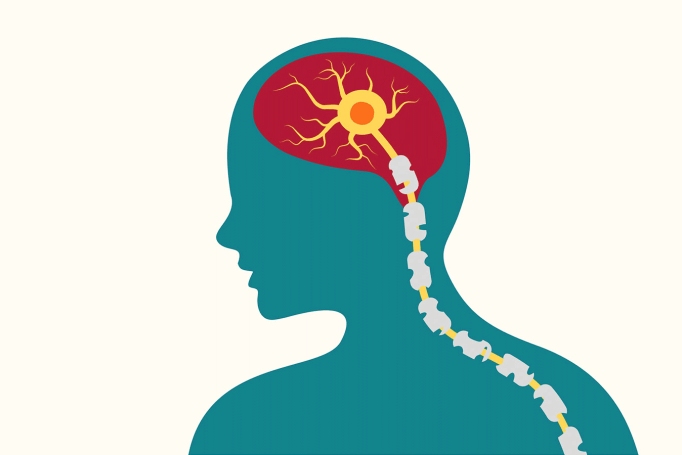 A graphic illustration of a silhouette featuring the spinal cord and a neuron in the brain. The illustration depicts mulitple sclerosis.