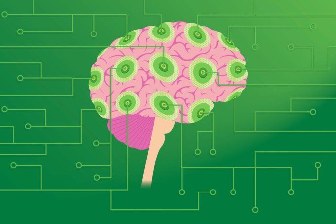 A stylized illustration of a human brain with a pink and green circuit-like design.