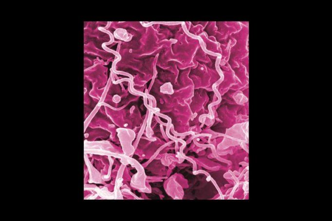 A microscopic image of Treponema pallidum, the bacteria that cause syphilis.
