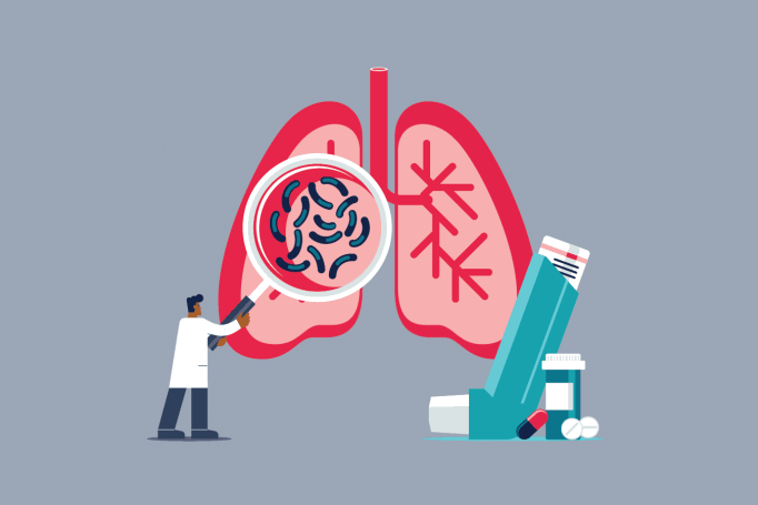 A graphic illustration depciting a doctor examining a pair of lungs with a magnifiying glass. Next to the lungs are an inhaller and medication in the form of pills, signifying treatment for asthma or C O P D.