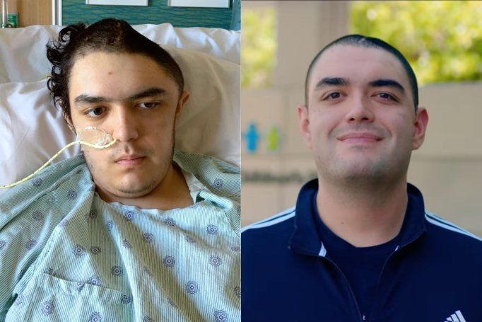 A side by side image showing stroke patient Andrew Santos when he was hospitaliezed at age seventeen, and him in the present day fully recovered.
