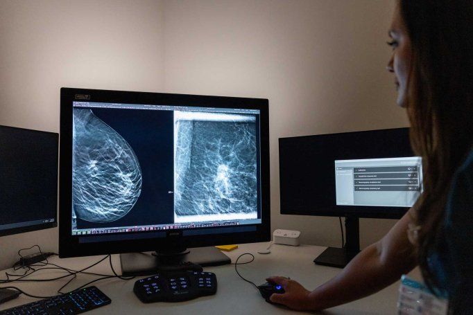 A medical practitioner looks at mammogram scans on a computer screen.