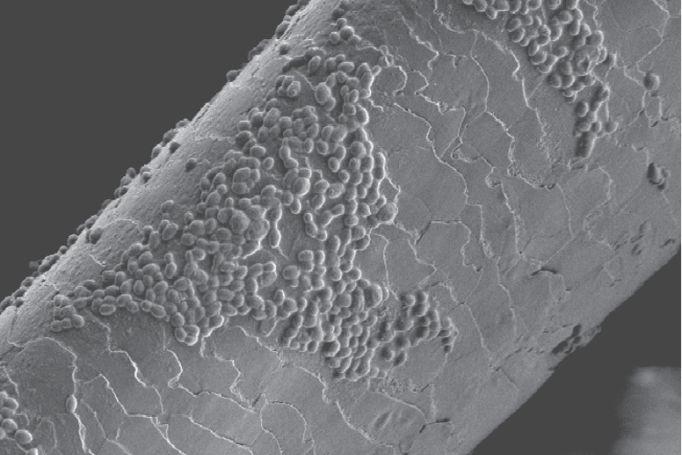 Scanning electron microscope image of Candida auris spores clustered on an infected hair follicle.