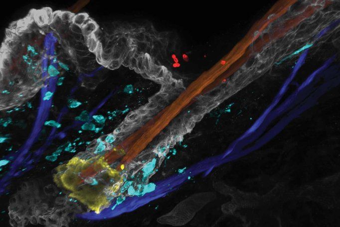 Fluorescent microscopy image of a hair follicle showing Candida auris cells and immune cells in the surrounding skin.