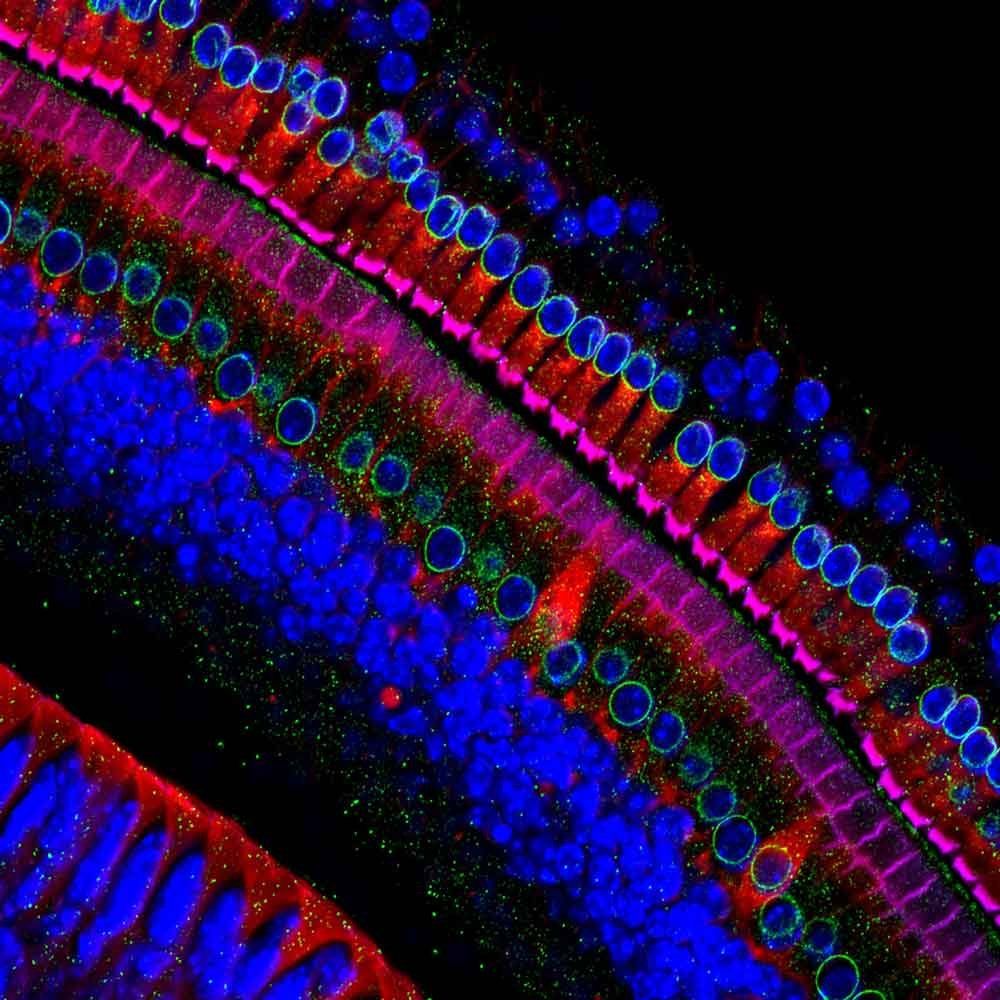A microscopig image of hair cells, hair-like structures in the inner ear that convert sound into brain signals.