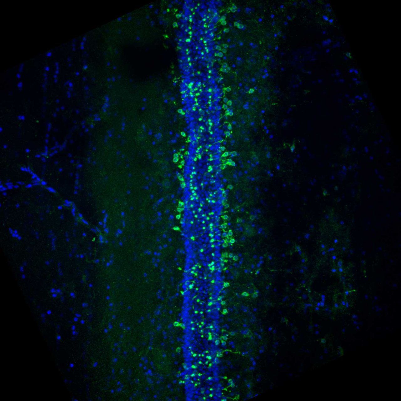 A microscopic image of cerebrospinal fluid-contacting neurons lining the central canal along the spinal cord.