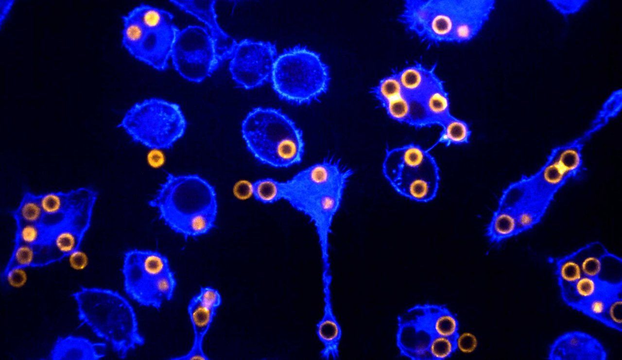Microscopy image of macrophages, a type of immune cell. The blue cells vary in shape and size and contain numerous bright orange spherical structures, creating a vivid contrast against the black background.
