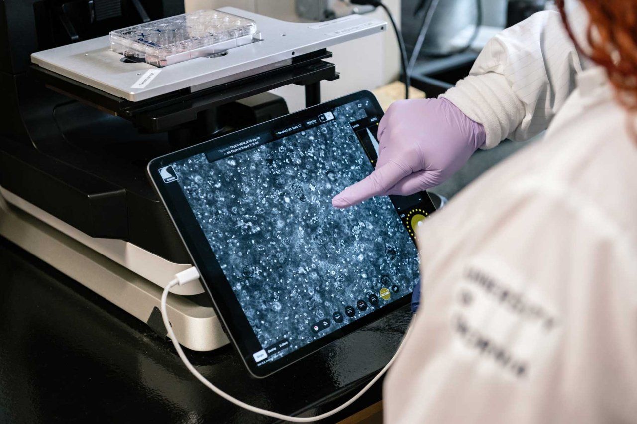 A scientists points at an iPad screen showing a microscope screen displaying small blue clusters that are breast cancer organoids.