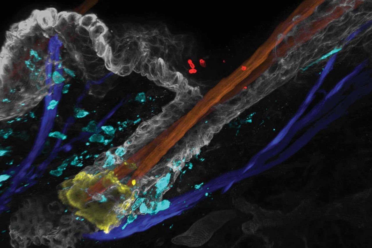 Fluorescent microscopy image of a hair follicle showing Candida auris cells and immune cells in the surrounding skin.