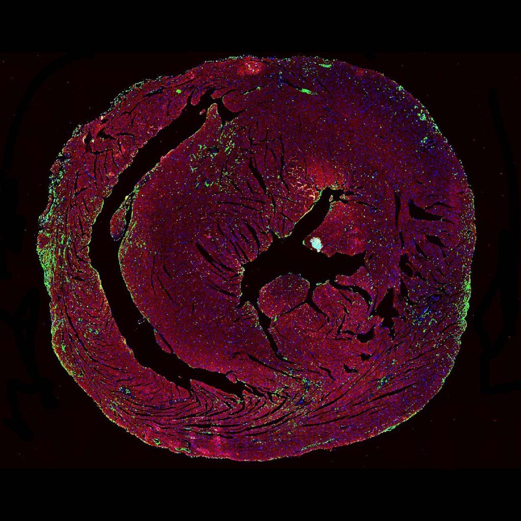 Microscopy of a mouse heart with immune infiltrates indicating ICI-myocarditis.
