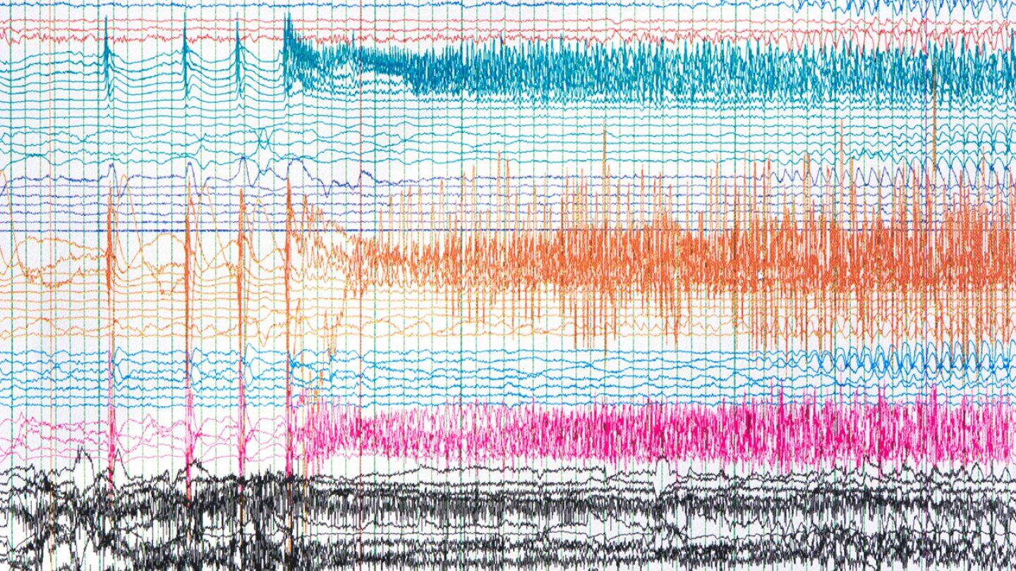 Squiggly lines show a seizure taking place over time on an EEG