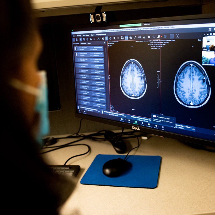 Over Zoom, Cheryl Broyles discusses the results of her MRI while looking at scans of her brain