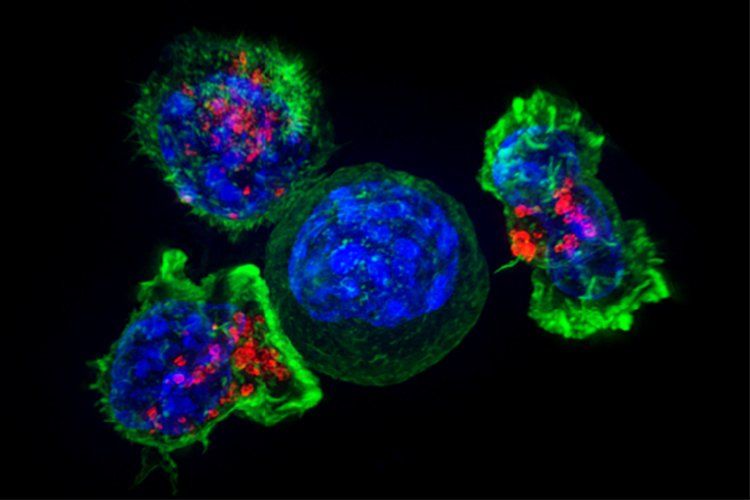 Immune system T-cells surround a cancerous cell