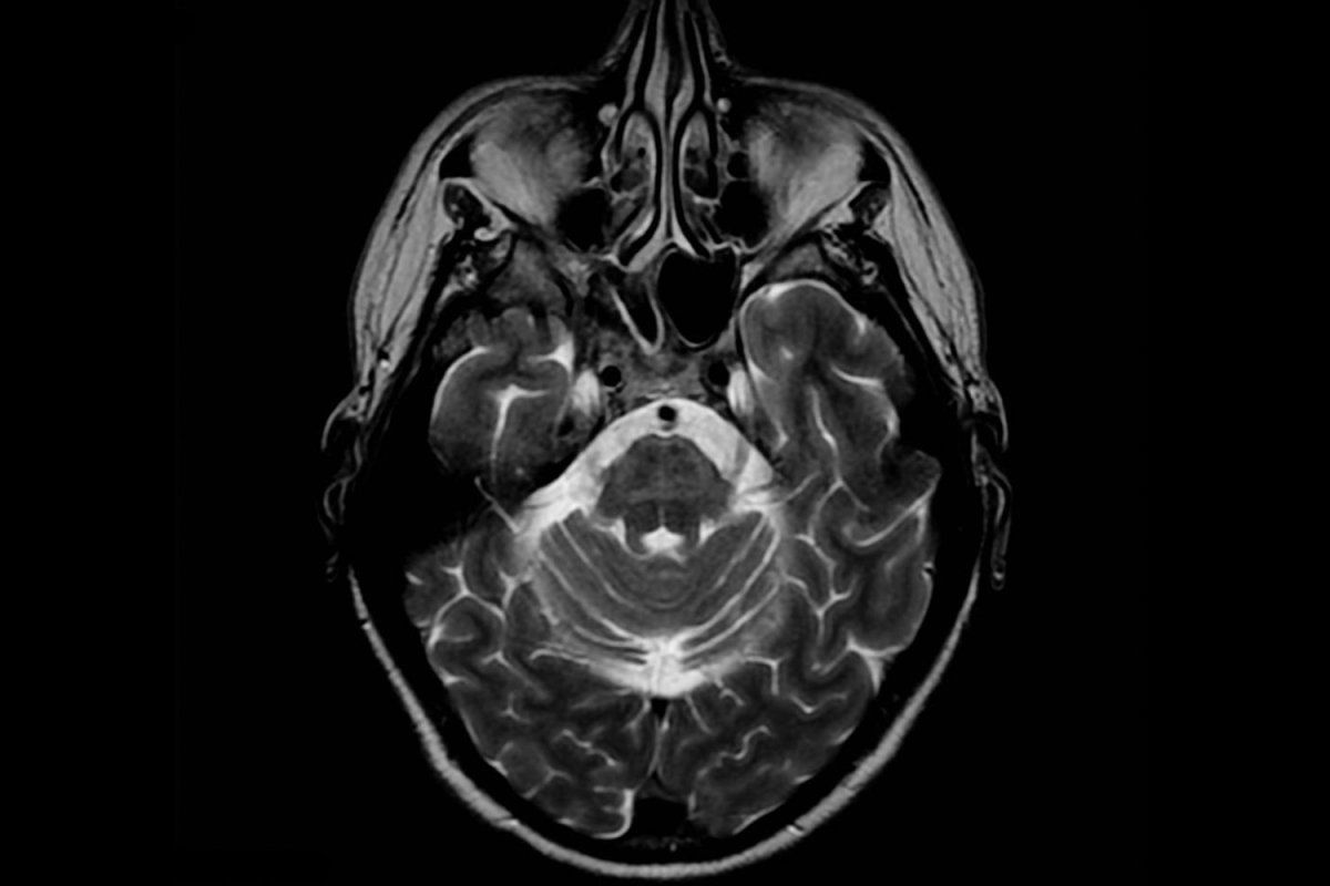 Medical scan of human brain