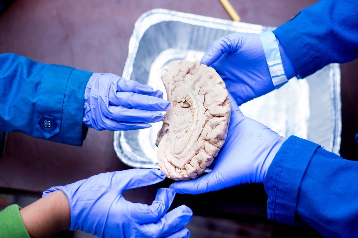 kids touch a human brain