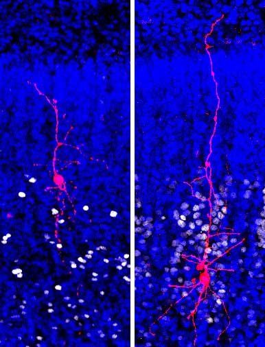 Microscope image of human cortical neuron.