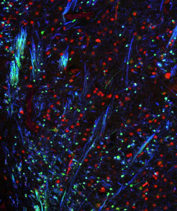 Immature amygdala neurons in green and blue