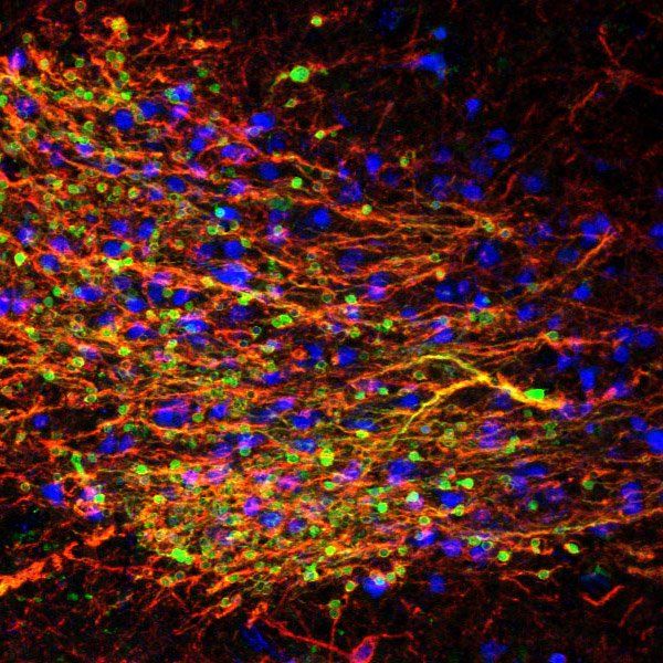 Immature amygdala neurons
