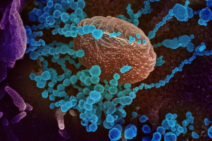 Microscopic image of the new coronavirus, SARS-CoV-2, emerging from cell